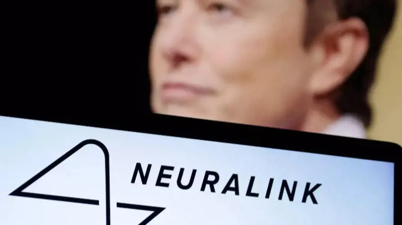 イーロン・マスクの注目すべき取り組み: Neuralink がブレイン・マシン・インターフェースの人体実験を実施